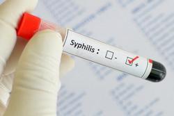 Лечение сифилиса фото